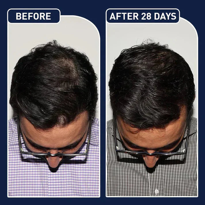 FEG Plus Hair Strong Growth Spray 100% Original For Men & Women