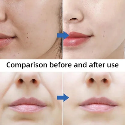 V-face Lifting Mask 10 Pairs Set