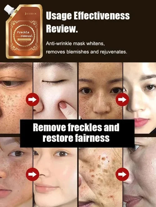 2024 New Anti-Blemish & Anti-Aging Tear-Off Mask