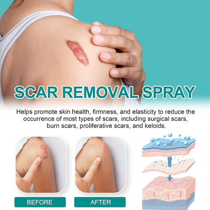 Advanced Scar Remove Spray