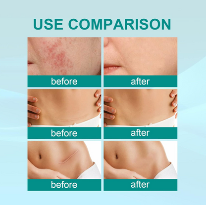 Advanced Scar Remove Spray
