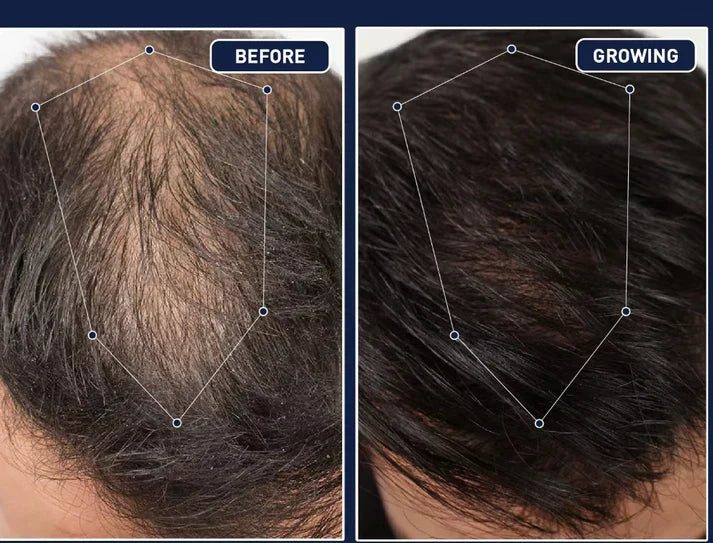 FEG Plus Hair Strong Growth Spray 100% Original For Men & Women