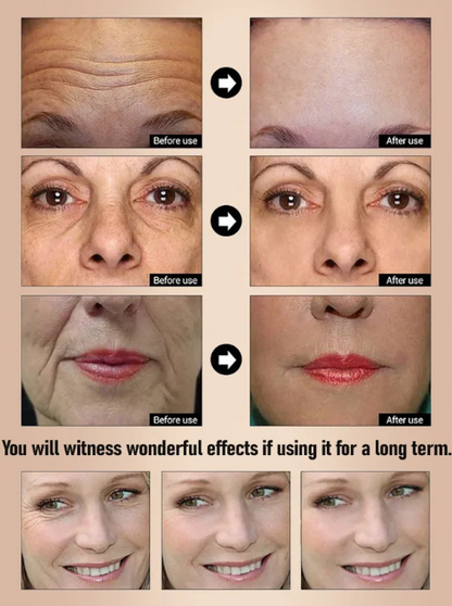 Anti-Aging Wrinkle-Removing Serum