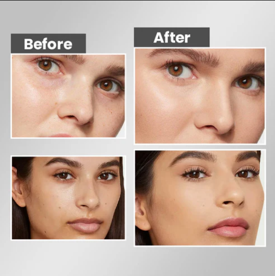 Whitening Hydrating Freckle Removing Face Cream