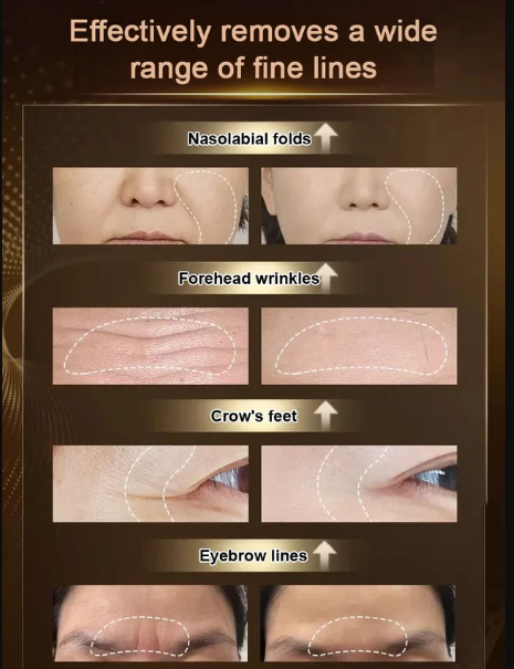 Boswellia Wrinkle Resistant Essence