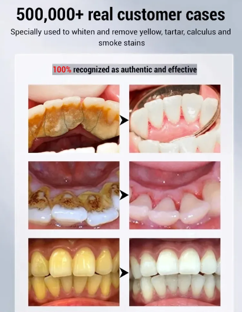 Baking Soda Enzyme Whitening Toothpaste
