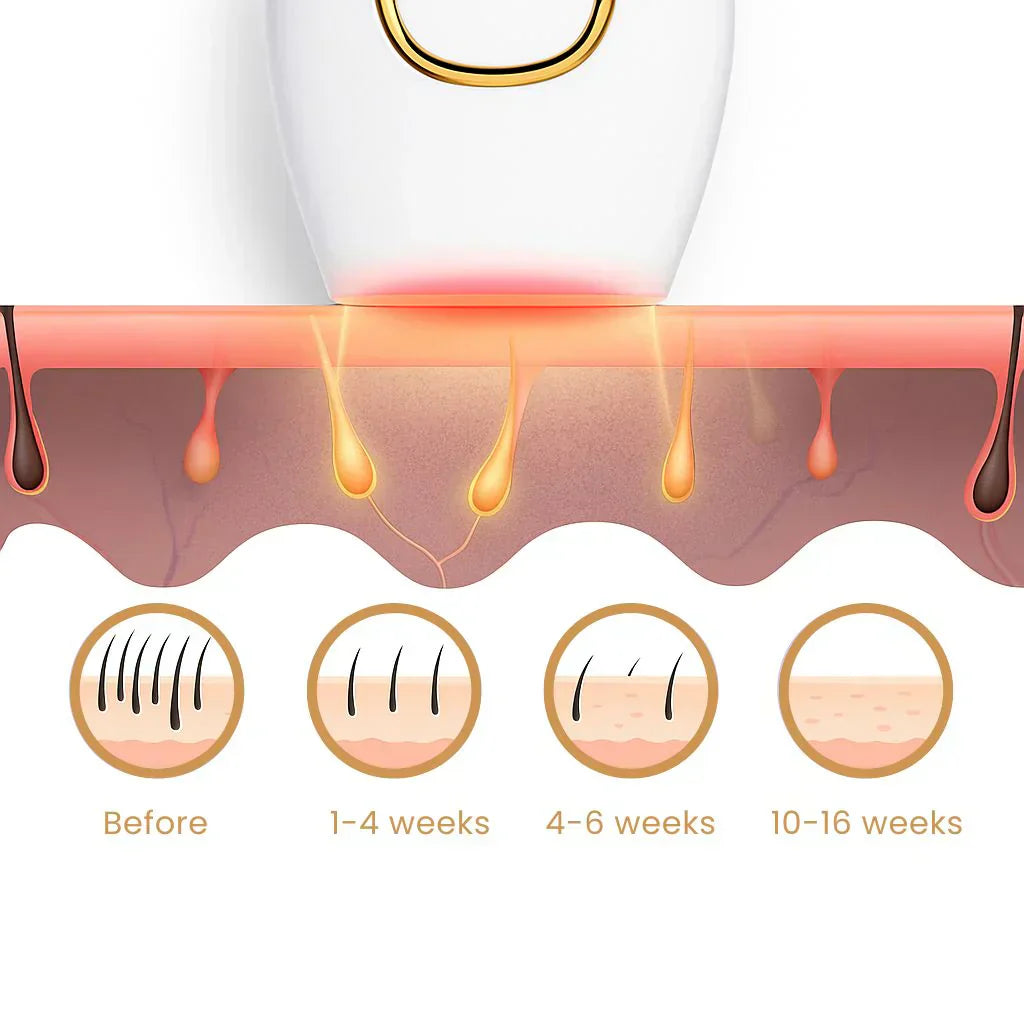 The Leading At-Home Solution for Smooth Skin